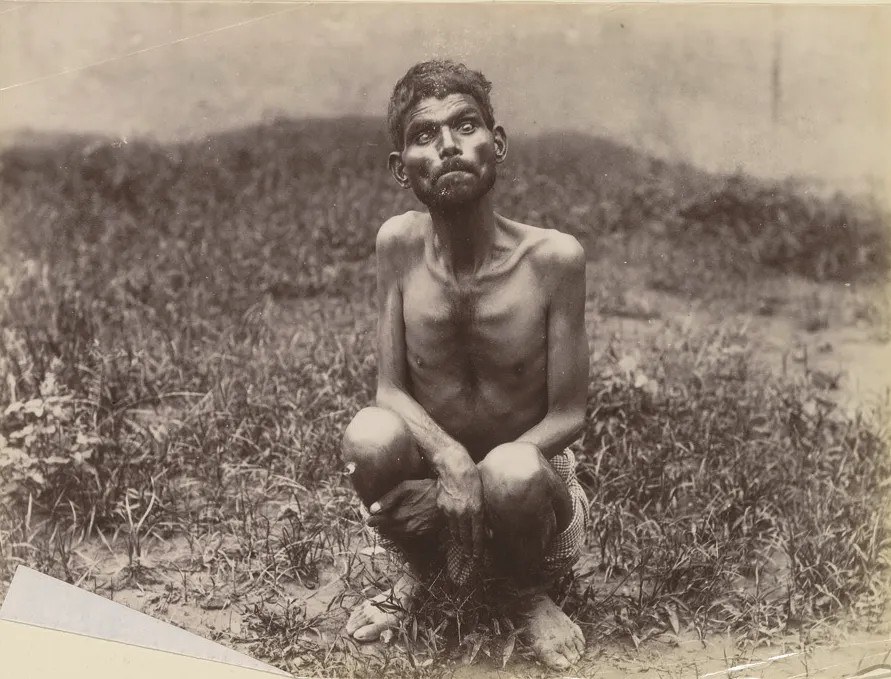 Dina Sanichar, a feral child found in Victorian India